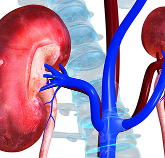 Connection Between Kidney Transplant Cost and Medical Tourism in India