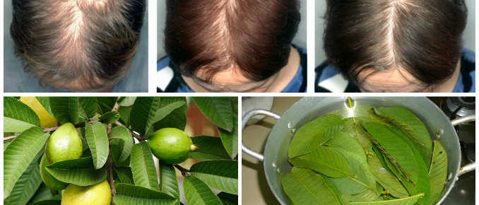 Guava Leaves Can Stop Your Hair Falling-100% And Make It Grow Like Crazy