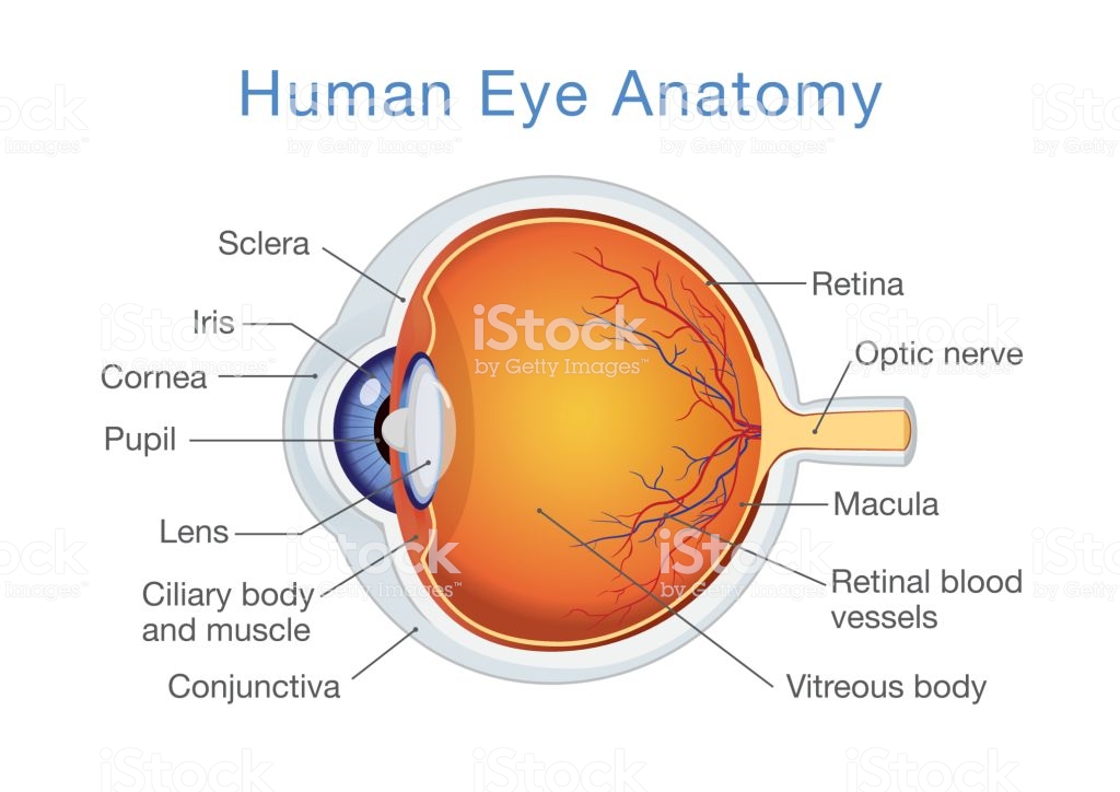 Myopia eye