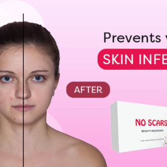 Effective Treatments to Remove Scars